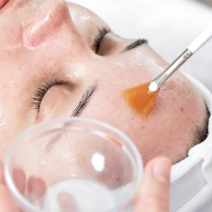 The Skin Lab Pro Beta Peel – Blemish & Acne Treatment