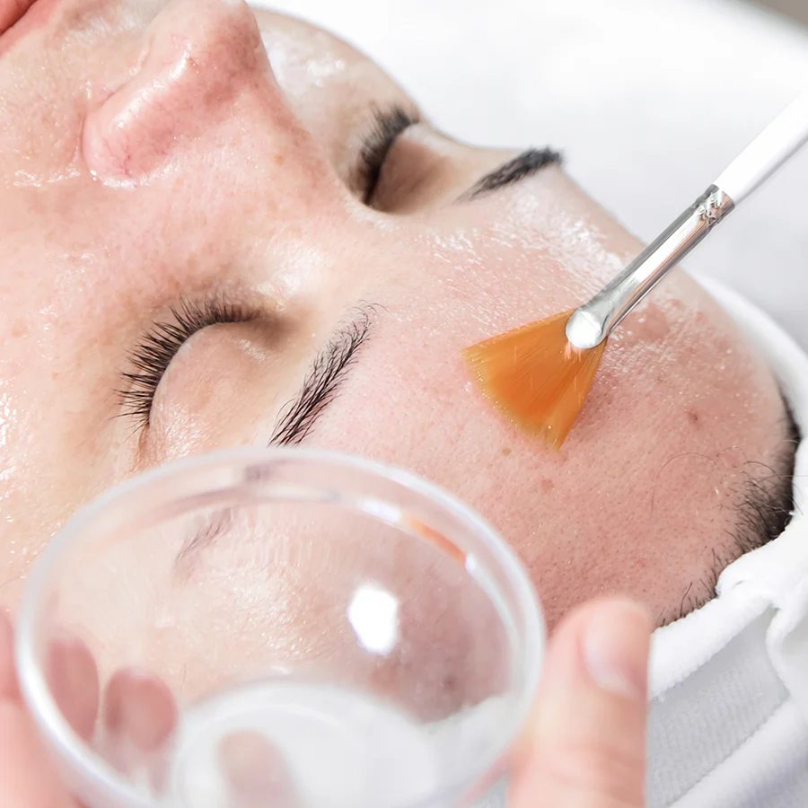 The Skin Lab Pro Beta Peel - Blemish & Acne Treatment